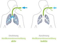 SALVIA medical stellt den ersten Beatmungs-Adaptiven Mesh-Vernebler vor - m-neb Flow+