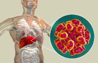Cholesterin mal anders - Cholesterin-Stoffwechsel als Angriffspunkt im Kampf gegen Hepatitis-E-Viren