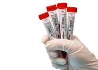 ViraxClear meldet Vertriebsvereinbarung für COVID-Schnelltest in Asien