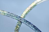 New Data on BIOTRONIK Orsiro Hybrid