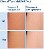 Radianskin - combining efficacy and skin tolerance for advanced skin whitening