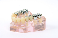 Suntech® Light®: Hochwertig, ästhetisch und biokompatibel!