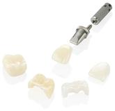 Die ultimative Lösung für implantatgetragene Kronen