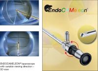 Laparoscopy