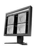 EIZO Monitor SMD 19102 DL reduziert Strahlenbelastung bei älteren Röntgenanlagen