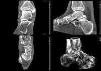 Perspektive DVT – Einsatz als Primärdiagnostik mit höchster Strahlenhygiene