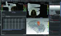 YXLON CT goes VGStudio MAX 3.0