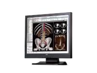 Neuer Farbmonitor zur Bildbetrachtung in der Radiologie