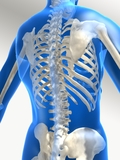VESTAKEEP® Polymers for Medical Applications