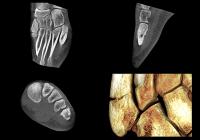 Perspektive DVT – Anwendung der DVT in der sportmedizinischen Extremitätendiagnostik