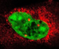 MHH-Neuroanatomen entdecken molekularen Mechanismus für die Regulation der Zellkernstruktur
