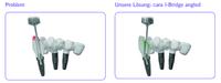 Round Tables zum Einsatz der cara I-Bridge®