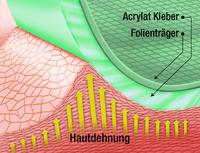 Erstes Augenpflaster mit sanfter Silikonhaftung