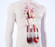 Berlin Heart Today Announces CE Approval and First Implantation of an Innovative Bridging Solution for Single Ventricle Patients