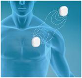 Zukunftsweisende, kabellose Energieversorgung von zahlreichen Implantaten und Medizinprodukten mit MedBase®