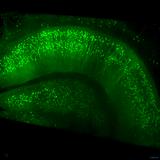 ZEISS to Offer Advanced Microscope Technology for Imaging of Cleared Tissue