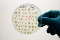 BRAIN AG gibt Gründung der SolasCure Ltd. zur Fortentwicklung der Aurase® bekannt