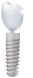Ästhetisch überragende Ergebnisse mit den neuen ANKYLOS® C/X und XiVE® custom abutments by Compartis®