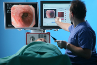 Diagnosehilfe bei Speiseröhrenkrebs