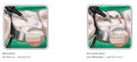 Venus® Bulk Fill: Eine Schicht genügt
