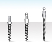 Erstmals auf den Fachdentals zu erkunden: MDI-Mini-Implantate aus dem Hause 3M ESPE