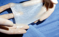 Neue Vertriebskooperation für das Dermisimplantat zur Brandwundenbehandlung Matriderm