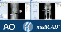 AO and mediCAD