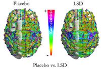 Wie LSD das Ich auflöst