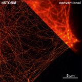 ibidi's µ-Slides in der "Super-Resolution" Lebendzellmikroskopie genauso leistungsfähig wie Glas