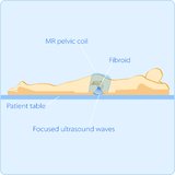 Ultraschall - von der Diagnostik zur Therapie
