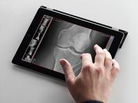 Flexibel dank dicomPACS®MobileView: Mobile Freiheit jederzeit und an jedem Ort