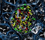 Neuer Ansatzpunkt für Regenerative Therapien