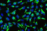 Folgenreicher Fehler: Neurale Stammzellen werden durch epigenetische Reprogrammierung zu Treibern kindlicher Hirntumoren