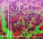 Neues Protokoll erlaubt Analyse von Stoffwechselprodukten aus fixiertem Gewebe