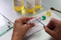 3M gewinnt Patentklage gegen Dental Direkt