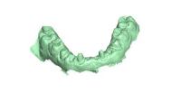 Digital, flexibel und offen - CEREC, ein Gesamtsystem für Restaurationen, Implantologie und Kieferorthopädie