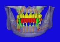 Individueller Kundenservice auch im Bereich Guided Surgery