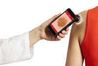handyscope für iPhone 6: Mobile Hautkrebsdiagnostik mit dem Smartphone