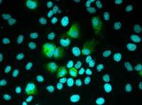 Eine neue Chance für die Hepatitis-C-Forschung