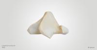 Biocompatible implants - 3D-printing supports medical sector