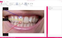 Farbkommunikation leicht gemacht – Kostenlose PC-Software VITA Assist in neuem Design