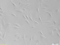 BRAIN granted key patent in the United States