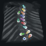 ECR 2020: New imaging solutions for enhanced clarity and cost-efficiency