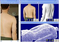 3D Surface Models from Photographs