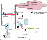 FDA-Zulassung für LIFEBRIDGE® - den Lebensretter aus Bayern