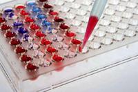Kostenlose Fortbildungsveranstaltung informiert Hamburger Ärzteschaft über die Optimierung von Chemotherapien anhand zirkulierender Tumorzellen