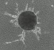 Eierstockkrebs: Neues Tumorsuppressor-Gen charakterisiert