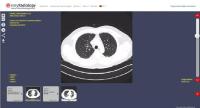 EasyRadiology - der Abschied von der Patienten-CD
