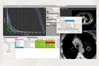 Automated 3D dose-volume verification: gearing up for complex planning scenarios