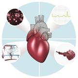 OP auf Probe: Philips leitet Forschungsprojekt "euHeart"